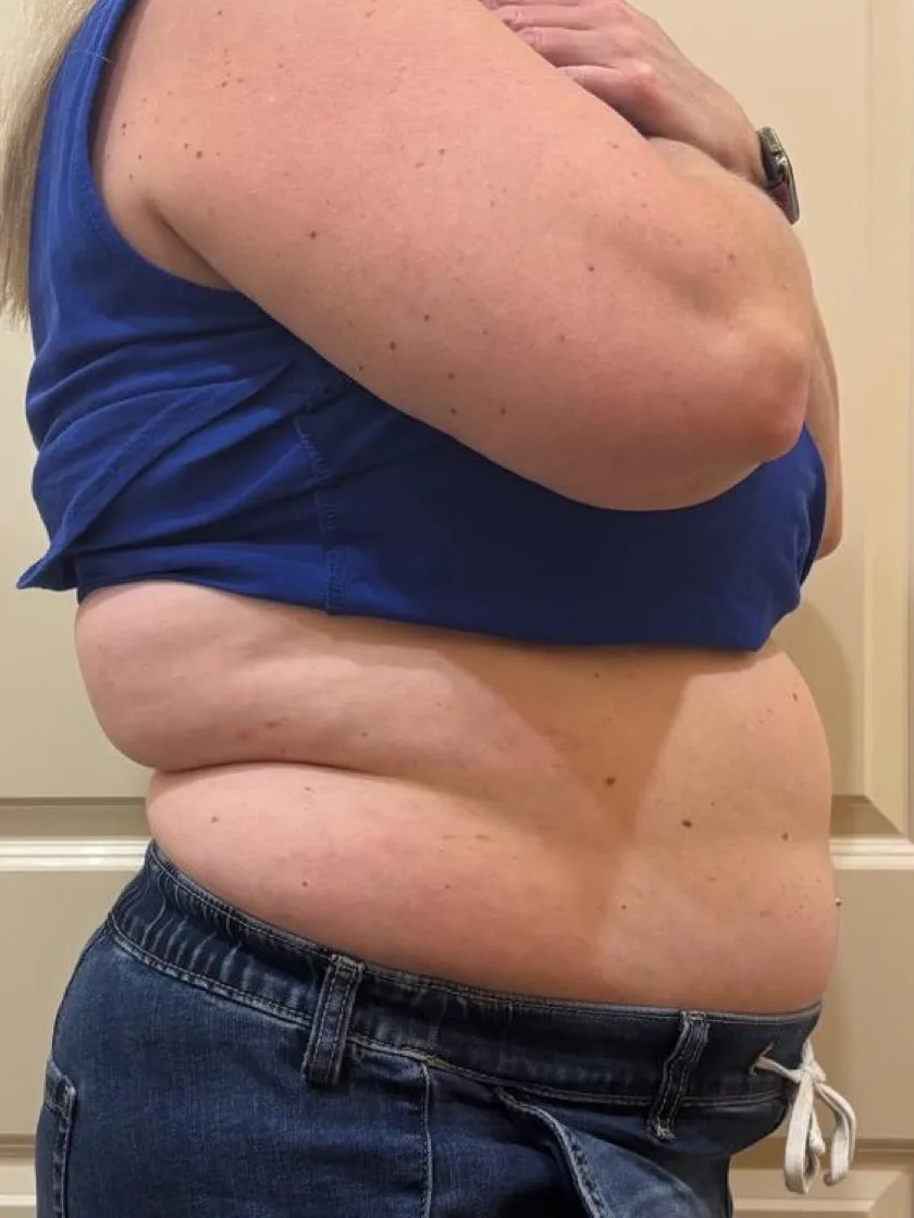 A guest's midsection, side view — before