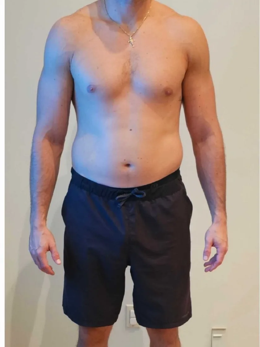 A guest's midsection, front view — before